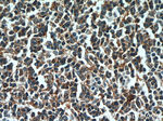 FUT7 Antibody in Immunohistochemistry (Paraffin) (IHC (P))