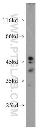 FUT7 Antibody in Western Blot (WB)