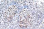 Cyclin A2 Antibody in Immunohistochemistry (Paraffin) (IHC (P))