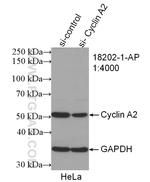 Cyclin A2 Antibody in Western Blot (WB)