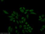 PBX1 Antibody in Immunocytochemistry (ICC/IF)