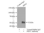 PBX1 Antibody in Immunoprecipitation (IP)