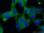 Dynamin 1 Antibody in Immunocytochemistry (ICC/IF)