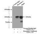 Dynamin 1 Antibody in Immunoprecipitation (IP)