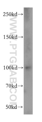 Dynamin 1 Antibody in Western Blot (WB)