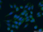 RPS9 Antibody in Immunocytochemistry (ICC/IF)