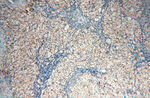 RPS9 Antibody in Immunohistochemistry (Paraffin) (IHC (P))