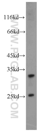 RPS9 Antibody in Western Blot (WB)