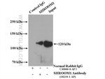 SHROOM1 Antibody in Immunoprecipitation (IP)