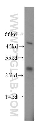 UBE2S Antibody in Western Blot (WB)