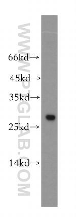 UBE2S Antibody in Western Blot (WB)