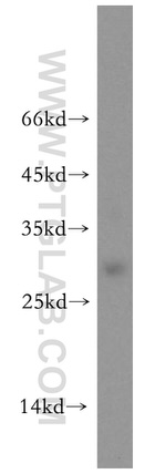 UBE2S Antibody in Western Blot (WB)