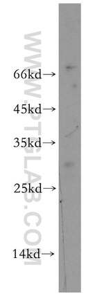 UBE2S Antibody in Western Blot (WB)