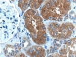 IkB alpha Antibody in Immunohistochemistry (Paraffin) (IHC (P))