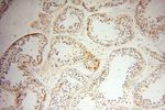 NFATC3 Antibody in Immunohistochemistry (Paraffin) (IHC (P))