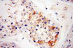 NFATC3 Antibody in Immunohistochemistry (Paraffin) (IHC (P))