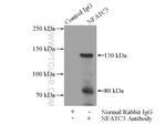 NFATC3 Antibody in Immunoprecipitation (IP)