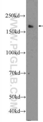 NFATC3 Antibody in Western Blot (WB)