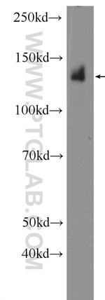 NFATC3 Antibody in Western Blot (WB)