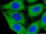 CYP3A4 Antibody in Immunocytochemistry (ICC/IF)