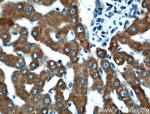 CYP3A4 Antibody in Immunohistochemistry (Paraffin) (IHC (P))