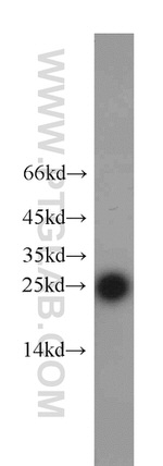 RPS8 Antibody in Western Blot (WB)