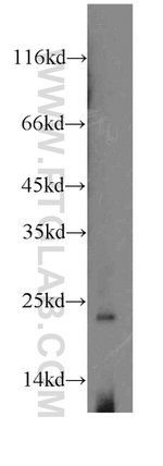 RPS8 Antibody in Western Blot (WB)