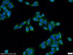 PDIA6 Antibody in Immunocytochemistry (ICC/IF)