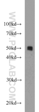 PDIA6 Antibody in Western Blot (WB)