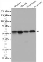 PDIA6 Antibody in Western Blot (WB)