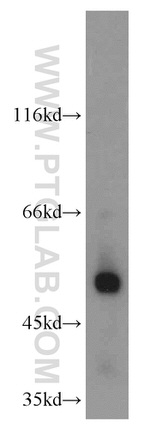 PDIA6 Antibody in Western Blot (WB)