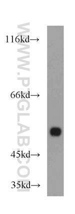 PDIA6 Antibody in Western Blot (WB)