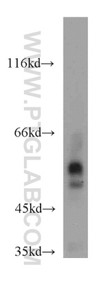 PDIA6 Antibody in Western Blot (WB)