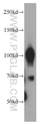 TRPC6 Antibody in Western Blot (WB)