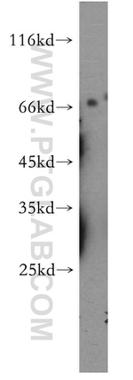 MMP28 Antibody in Western Blot (WB)