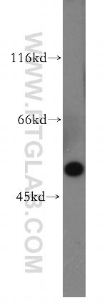 MMP28 Antibody in Western Blot (WB)