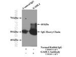 GADL1 Antibody in Immunoprecipitation (IP)