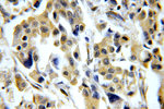 CHST3 Antibody in Immunohistochemistry (Paraffin) (IHC (P))