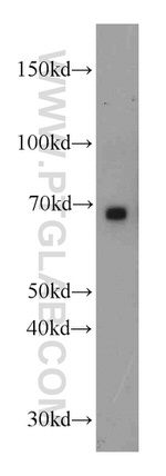 CHST3 Antibody in Western Blot (WB)