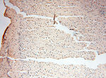 EIF2AK2/PKR Antibody in Immunohistochemistry (Paraffin) (IHC (P))