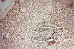 EIF2AK2/PKR Antibody in Immunohistochemistry (Paraffin) (IHC (P))