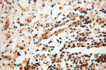 EIF2AK2/PKR Antibody in Immunohistochemistry (Paraffin) (IHC (P))