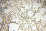 EIF2AK2/PKR Antibody in Immunohistochemistry (Paraffin) (IHC (P))