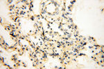 EIF2AK2/PKR Antibody in Immunohistochemistry (Paraffin) (IHC (P))