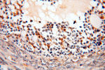 EIF2AK2/PKR Antibody in Immunohistochemistry (Paraffin) (IHC (P))