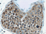 EIF2AK2/PKR Antibody in Immunohistochemistry (Paraffin) (IHC (P))