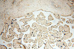 EIF2AK2/PKR Antibody in Immunohistochemistry (Paraffin) (IHC (P))