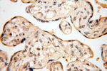 EIF2AK2/PKR Antibody in Immunohistochemistry (Paraffin) (IHC (P))