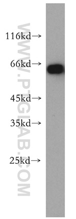 EIF2AK2/PKR Antibody in Western Blot (WB)