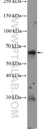 EIF2AK2/PKR Antibody in Western Blot (WB)